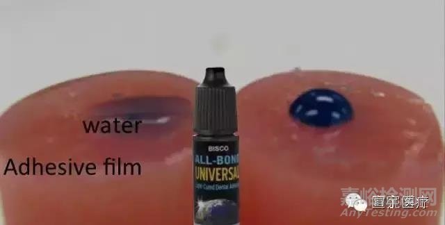 牙科粘結劑的粘接原理和主要質量檢測項目