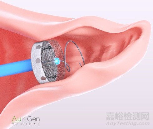 AuriGen LAA：擁有消融功能的左心耳封堵器