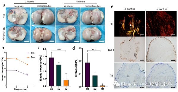 3D生物打印仿生半月板支架應用于組織工程領域