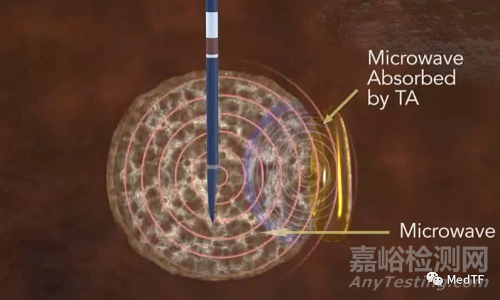 HeatSYNC Gel：讓微波消融變更為圓潤
