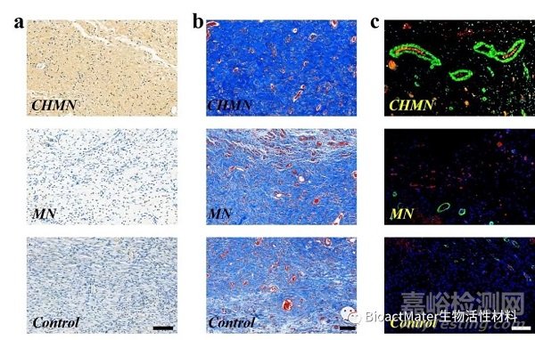 中藥微針補片用于創面修復|Bioactive Materials