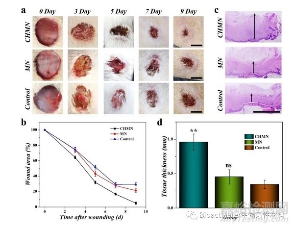 中藥微針補片用于創面修復|Bioactive Materials