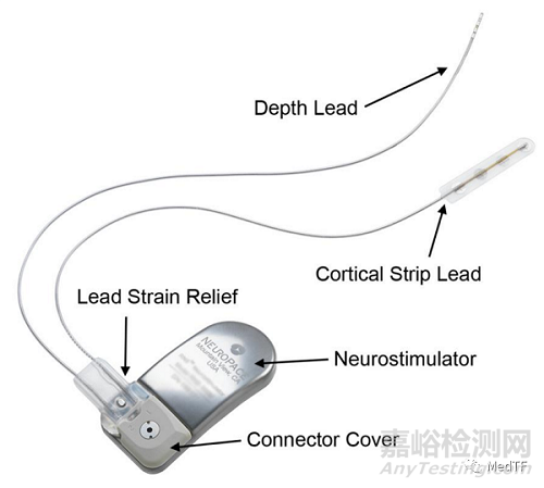 RNS System：FDA唯一批準的閉環腦反應神經刺激系統預防癲癇發作