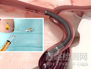 Vena BDAC：球囊+抽吸新型導管 血栓清除只需10分鐘