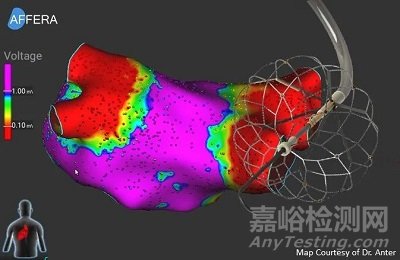 Affera：美敦力首款三維標(biāo)測(cè)和消融系統(tǒng)獲CE批準(zhǔn)