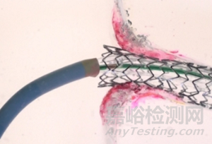 FLASH：冠脈開口病變的雙球囊技術