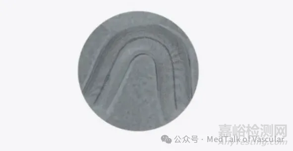 國產首款新型涂層血流導向密網支架技術解析
