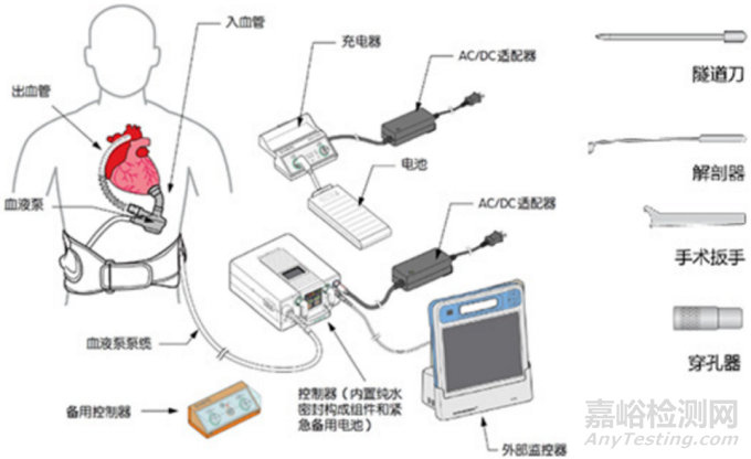 【創新醫械】基于獨特波浪膜技術的左心室輔助裝置