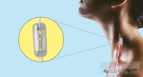 【創(chuàng)新醫(yī)械】SetPoint：首款神經(jīng)免疫刺激器獲FDA批準(zhǔn)，治療類風(fēng)濕關(guān)節(jié)炎