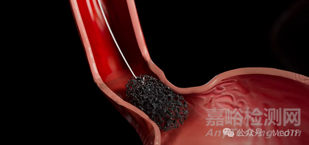 【創新醫械】EndoSign：食管癌檢測膠囊