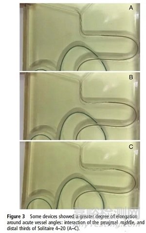 支架取栓器的設計與制造